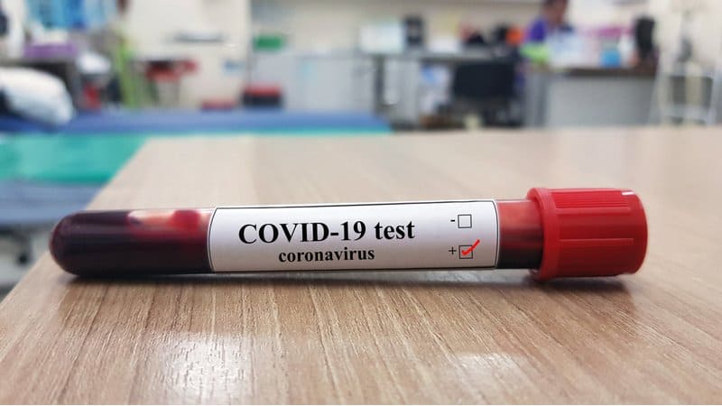 covid 19 coronavirus testing